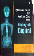 Optimisasi Dosis dan Kualitas Citra pada Radiografi Digital